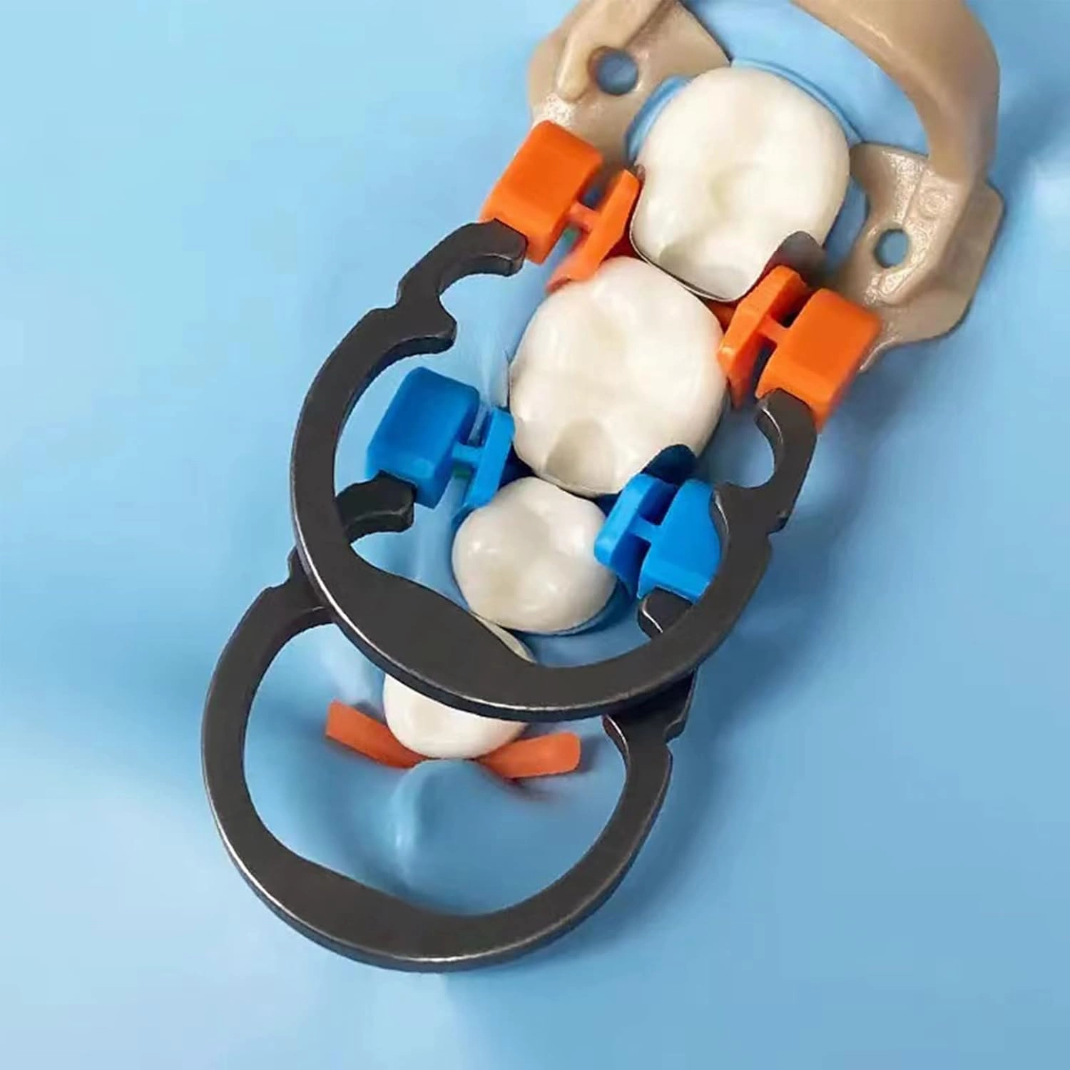 Dental Sectional Matrix Ring Clamp Spring Clip, Autoclavable Nickel Titanium Orthodontic Clamp Rings, Contoured Matrices System for Pre and Post Molars. (R2 Blue Orange)